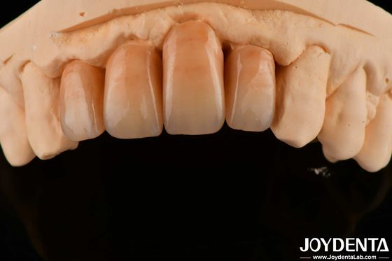 kopen Gepolijst gelaagd zirconia wit en duurzaam voor een perfecte oppervlakteafwerking online vervaardiging
