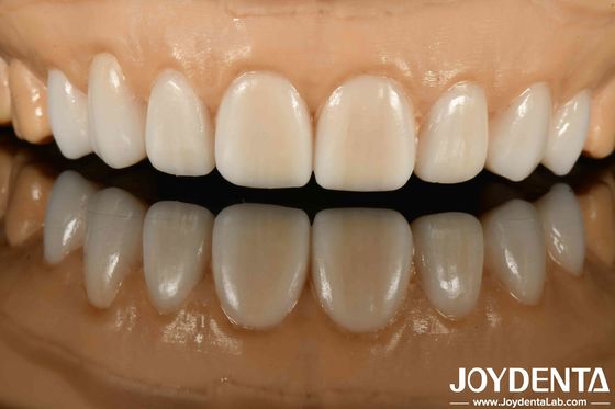 kopen Hoge stealth diverse materialen van metalen en harsen flexibele prothese afwerking voor geavanceerde stealth technologie online vervaardiging