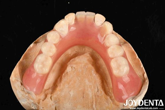 kopen Lichte, goede biocompatibiliteit Acrylprothese Finish Gepersonaliseerde aanpassing in medische apparatuur online vervaardiging