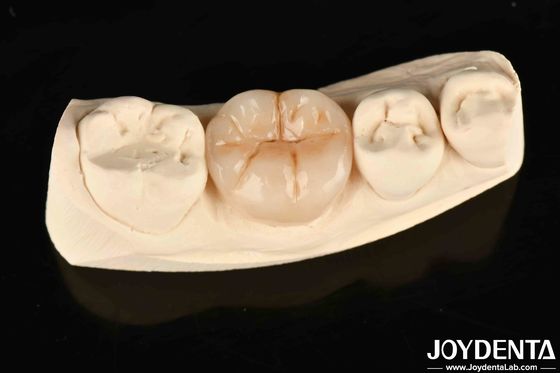 kopen Volledig Zirconia, hoge slijtvastheid en sterkte in industriële toepassingen online vervaardiging