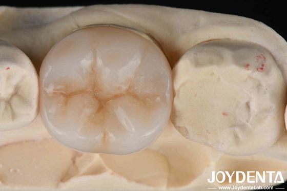kopen Multilayer Full Zirconia Ultieme combinatie van sterkte en esthetiek voor tandheelkundige restauratie online vervaardiging