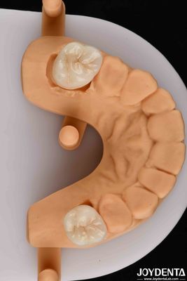 kopen Een natuurlijke esthetiek met biocompatibele tandheelkundige zirconia online vervaardiging