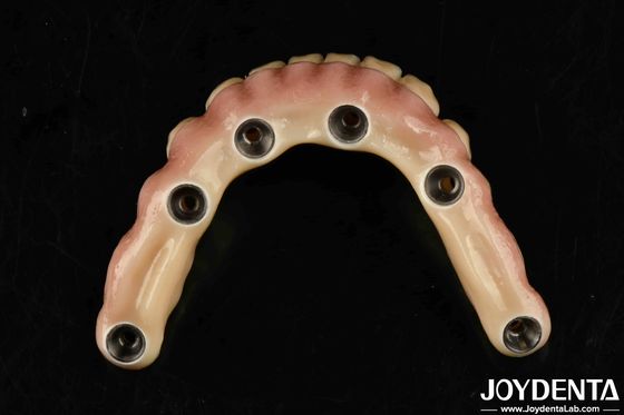 kopen Duurzame tandheelkundige esthetische titanium Malong Hybride brug voor de zorg online vervaardiging