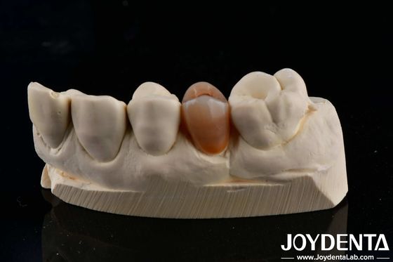 kopen Biocompatibel en natuurlijk uitziende meerlagig volzirkonium met esthetiek online vervaardiging