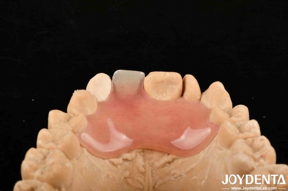 kopen Hoge stealth goede elasticiteit flexibele prothese afwerking voor verschillende productieprocessen online vervaardiging