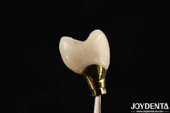 kopen Verscheidene groottes Implantat Kroon en brug Voor sterke tandheelkundige implantaten Compatibiliteit online vervaardiging