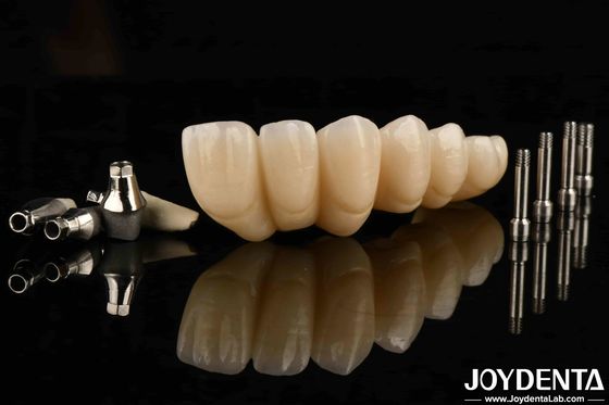 kopen Ervaar ultieme esthetiek met esthetisch aangename tandheelkundige implantaten kroon en brug online vervaardiging