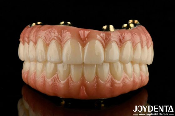 kopen Natuurlijke tanden en tandvlees Compatibele Ti-Bar Zirconia Hybride brug met hoge biocompatibiliteit online vervaardiging