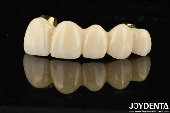 kopen Uitstekende sterkte Ti-Bar Zirconia Hybride brug voor natuurlijke tanden en tandvlees compatibiliteit online vervaardiging