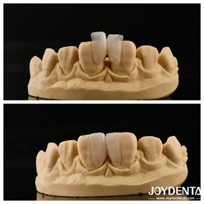 kopen Makkelijk te installeren Micro Veneer Ultieme oplossing voor interieur decoratie Dikte 0,2 mm online vervaardiging