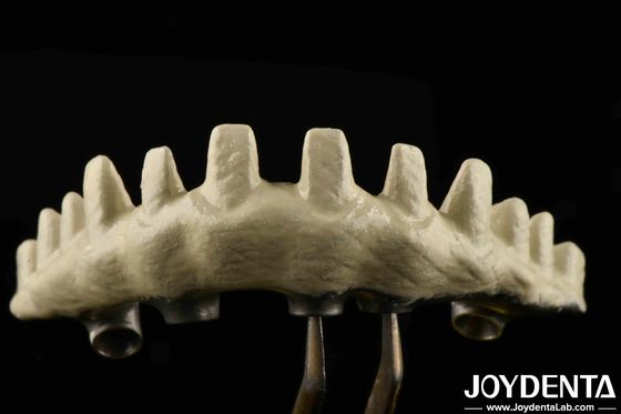 kopen Interne hex-verbinding Type Custom Implant Abutments Sandblasted And Acid-etched voor superieure pasvorm online vervaardiging