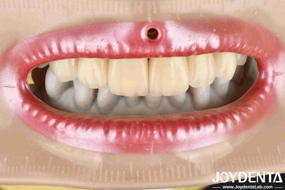 kopen Gelaagd Zirconia Hoge esthetiek Uitstekende biocompatibiliteit Sintertemperatuur 1350-1450°C Voor geavanceerde materialen online vervaardiging