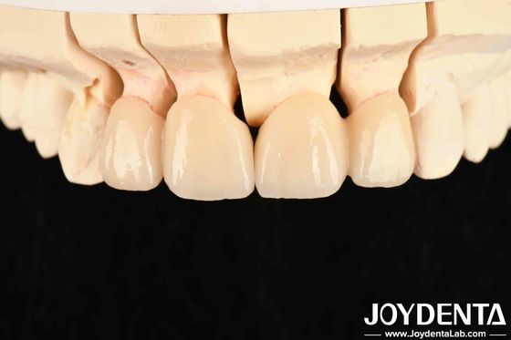 kopen Hoge doorschijnendheid gelaagd zirconia 3 W/mK thermische geleidbaarheid voor uitzonderlijke prestaties online vervaardiging