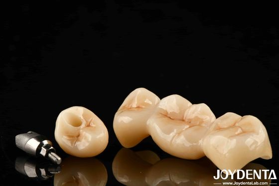 kopen Multilayer Full Zirconia hoge weerstand tegen scheuren en duurzaamheid voor langdurige tandheelkundige restauraties online vervaardiging