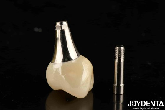 kopen Biocompatibele tandheelkundige implantaten Kroon en brug online vervaardiging