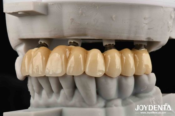 kopen Dichte Vrienden van Bones Foundation of Beauty Zirkonium Implantaat Esthetisch Superieure Keuze Zonder Risico op Metaalallergie online vervaardiging