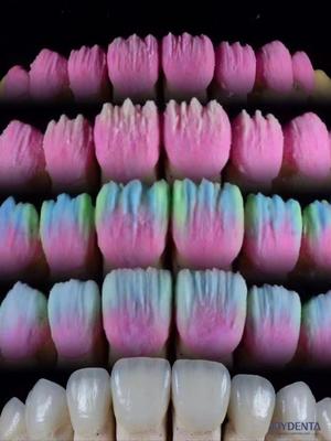 kopen The Joydenta Ceramic Veneer Process online vervaardiging