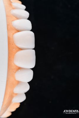 kopen Enhance Case Acceptance & Patient Communication with Our Diagnostic Wax-Up Service online vervaardiging