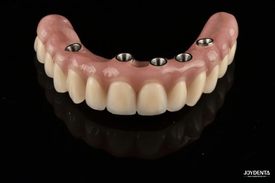 kopen Redefining Full Arch Prosthetics: Unmatched Fit and Function with Our Ti-Base Complete Dentures online vervaardiging