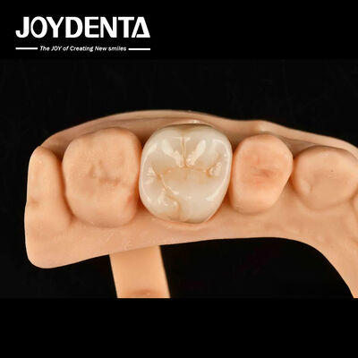 kopen Hoge slijtvastheid Tandheelkundig volledig Zirconia Hoge sterkte Volledige contour Zirconia brug online vervaardiging