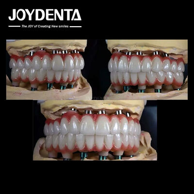 kopen 10 mm Titanium Meerdere Tanden Implantaten Ruwe oppervlakte Voor tandheelkundige restauratie online vervaardiging