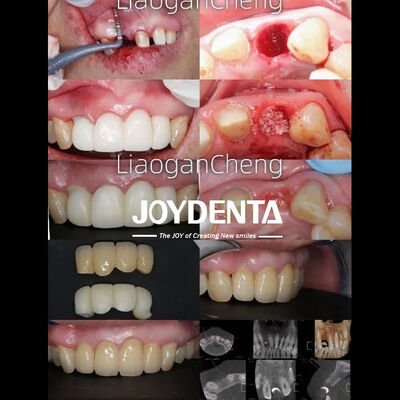 kopen Dental Zirconia Safe online vervaardiging