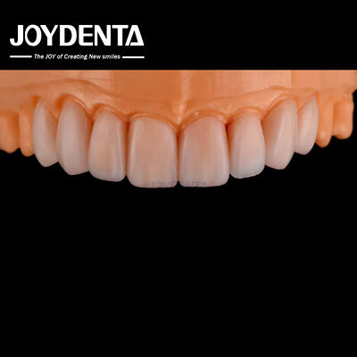 kopen Aanpasbaar glas keramische fineer natuurlijke uitstraling hoge chemische weerstand online vervaardiging