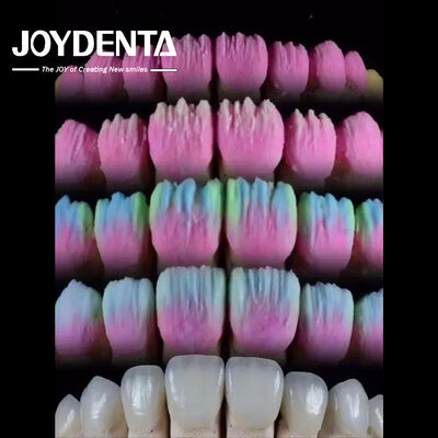 kopen The Joydenta Ceramic Veneer Process online vervaardiging