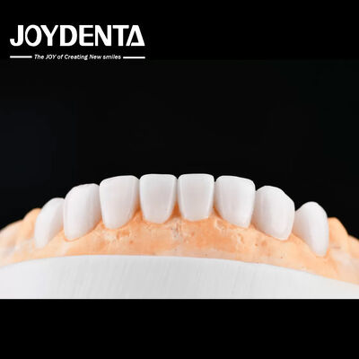 kopen Enhance Case Acceptance & Patient Communication with Our Diagnostic Wax-Up Service online vervaardiging