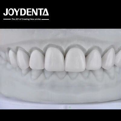 kopen Visualize the Result, Secure the Case: Our Diagnostic Wax-Up Service online vervaardiging