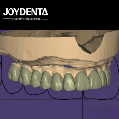kopen Gepersonaliseerd ontwerp Digitaal diagnostisch Wax Up Lab Software Naadloze integratie online vervaardiging