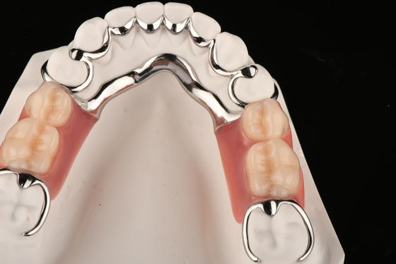 Vlekbestendige acryl partiële tandheelkunde voor natuurlijk comfort vervangt ontbrekende tanden
