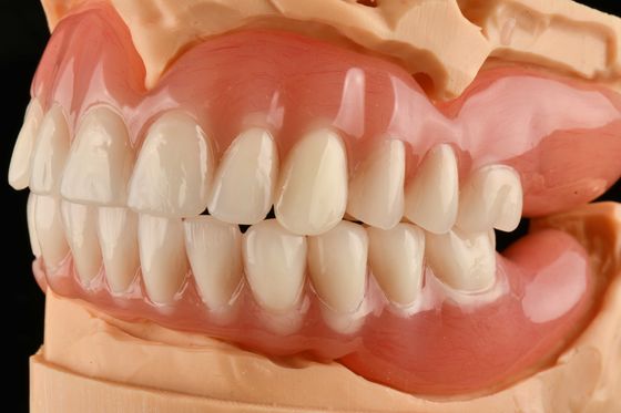 Onzichtbare gedeeltelijke / volledige tandheelkunde Geurloze hypoallergene acryl verwijderbare tandheelkunde