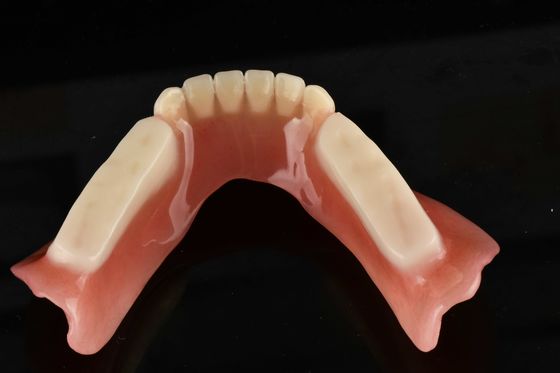 Goed geschikte hypoallergene kunstmatige acrylprothesen voor natuurlijke tandvervanging