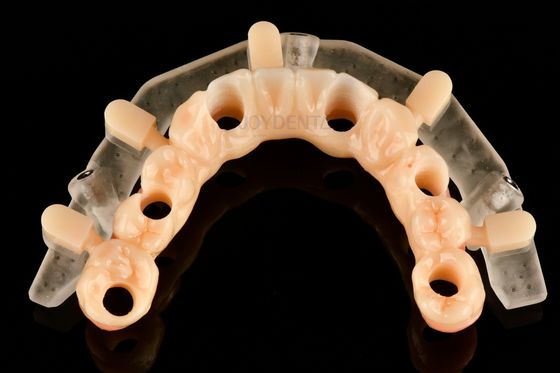 Custom Precision 3D Printed Guided Surgery Templates voor nauwkeurige implantaatplaatsing
