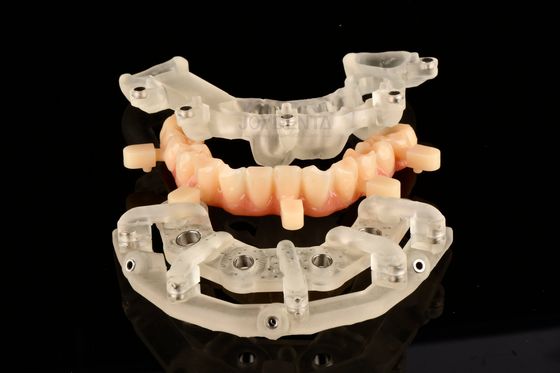 Titanium statisch geleide chirurgieoplossingen voor implantattherapie