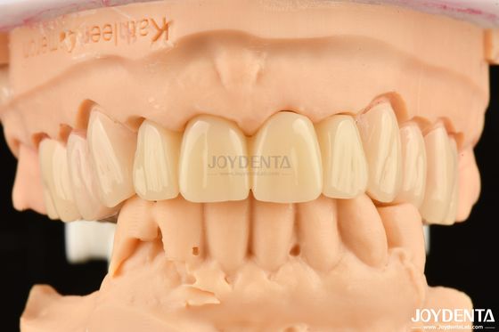 Biocompatibele PMMA M75 Restoratie Schramvast Voor tandheelkundige esthetiek