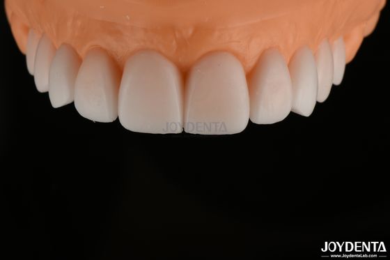 Glanzige, gerepliceerde diagnostische was, FDA, full arch tandwas, zeer nauwkeurig.