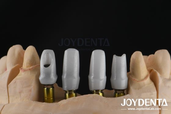 Aanpassing van tandheelkundige implantaten met zirconia-abutment voor eenmalige of meervoudige eenheidsherstelingen