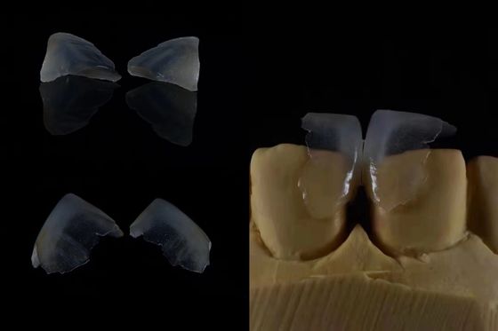 Comfortabele tandheelkundige veneers Sterke binding met tandglazuur voor een veilige pasvorm Lichtgewicht en glad voor optimaal patiëntcomfort