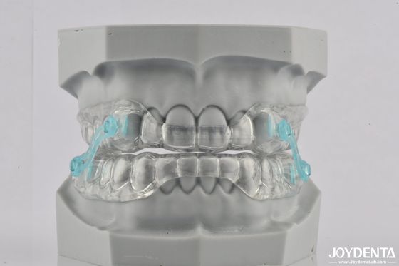 Silicone anti snurken mondstuk Stop snurken tandheelkundig apparaat Comfortabel