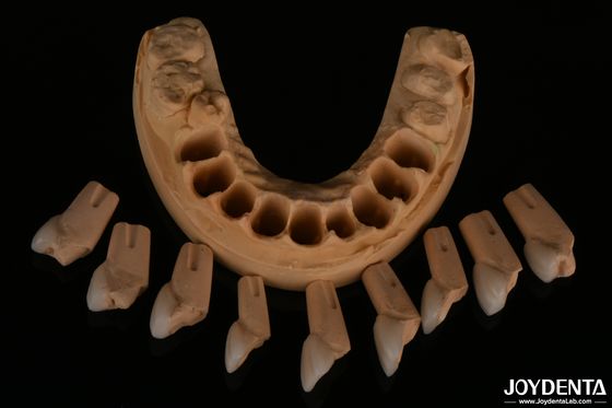 Precieze tandheelkundige feldspatische fineer zeer natuurlijk met een glanzende oppervlakte textuur