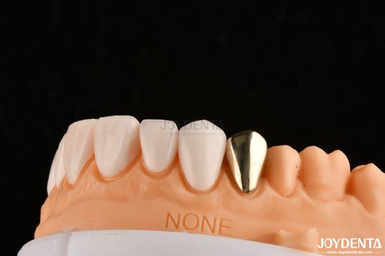 Ultra dunne IPS Emax-persfoelie cosmetische tandfoelie voor voor- en achterreparaties