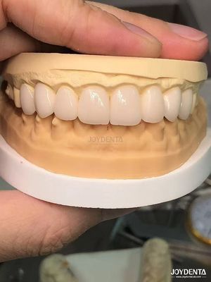 16 schakeringen Kleur Emax Tandheelkundige veneers A1-A4 Hoge vlekbestendigheid voor een perfecte glimlach