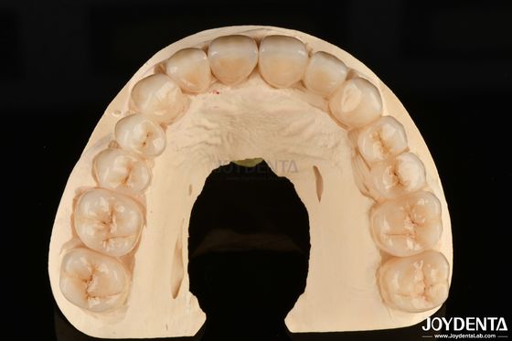 Hoge corrosiebestendigheid Volledig Zirconia Het voorkeurmateriaal voor witte tandherstel