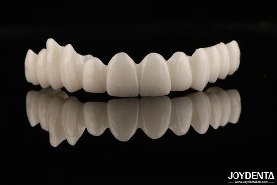 Hoge esthetiek Volledig Zirconia Hoge weerstand tegen corrosie en slijtage voor veeleisende toepassingen