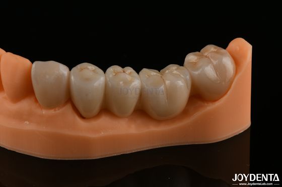 Precieze tandheelkundige herstelwerkzaamheden Volledig Zirconia Hoge buigsterkte Natuurlijke kleur