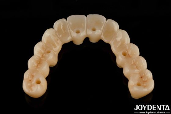 Hoge flexibiliteit Zirconia hybride brug met titanium basis