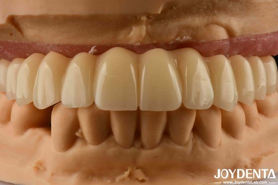 Tandheelkundige oplossing Ti-Base Zirconia Hybride brug Hoge biocompatibiliteit Natuurlijke uitstraling