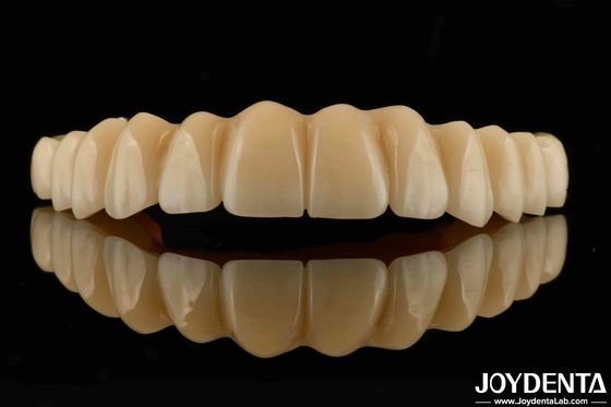 Titaniumbasis Zirconia Hybride brug Hoge corrosiebestendigheid Aanpassingsbehoeften